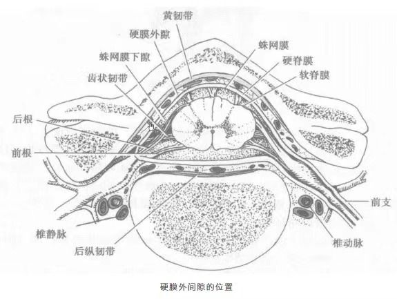 硬膜外镇痛技术原理解析:为什么无痛分娩不会让你“腰疼”? 健康养生